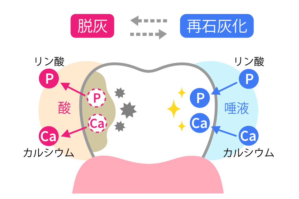 ごく初期の虫歯が自然に治る仕組み