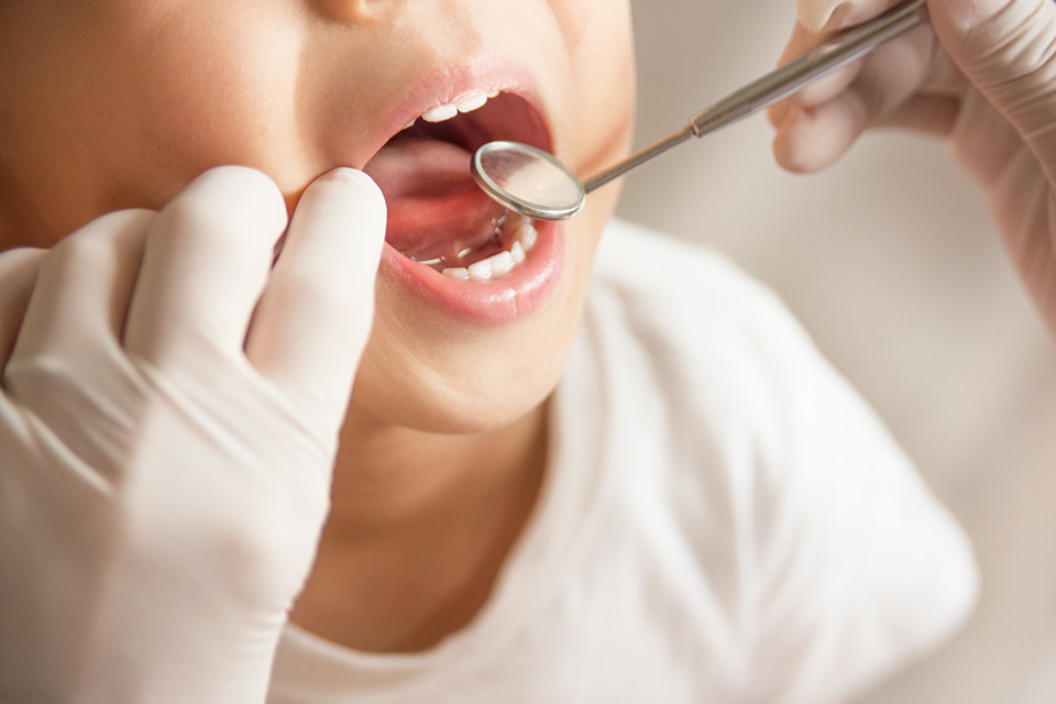 虫歯を作らないために、歯科医院に通う習慣をつけましょう