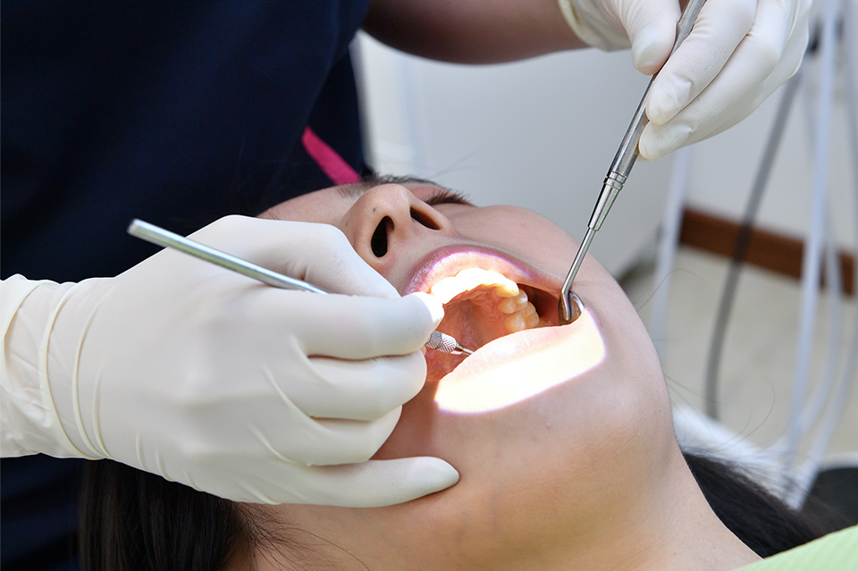 歯科衛生士によるケアは1時間しっかりと時間をとり、歯石などを徹底除去